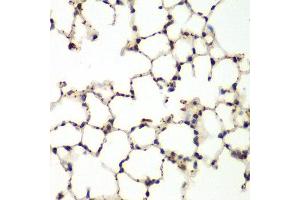 Immunohistochemistry of paraffin-embedded mouse lung using MAPK9 antibody at dilution of 1:200 (400x lens). (JNK2 anticorps)