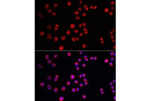 Immunofluorescence analysis of Neuro-2a cells using PTPN5 Rabbit pAb (ABIN7269705) at dilution of 1:150 (40x lens).