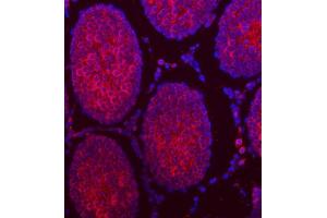 anti-Tubulin Tyrosine Ligase-Like Family, Member 2 (TTLL2) (AA 24-582) antibody