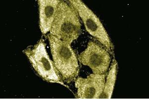 MDCK (ARHGEF7 anticorps  (AA 351-453))