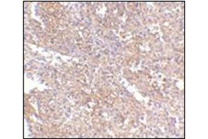 Immunohistochemistry of RAP80 in human spleen tissue with this product at 2.