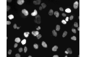 Immunofluorescent staining of HeLa (ATCC CCL-2) cells.