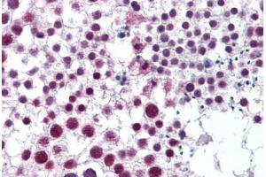 Human Testis: Formalin-Fixed, Paraffin-Embedded (FFPE) (Cyclin H anticorps  (AA 1-110))