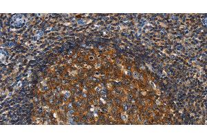 Immunohistochemistry of paraffin-embedded Human tonsil using GNA13 Polyclonal Antibody at dilution of 1:30