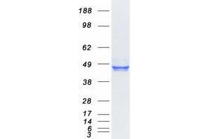 Validation with Western Blot