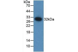 Detection of Recombinant F12, Mouse using Polyclonal Antibody to Coagulation Factor XII (F12)