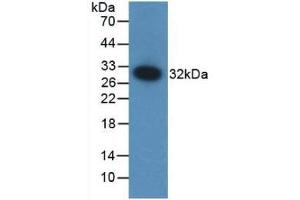 Detection of Recombinant F12, Mouse using Polyclonal Antibody to Coagulation Factor XII (F12) (F12 anticorps  (AA 352-587))