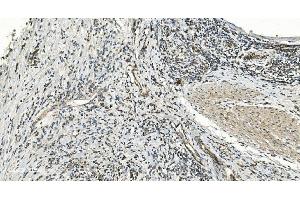 IHC analysis of FLCN using anti-FLCN antibody (ABIN7602491). (FLCN anticorps  (AA 8-551))