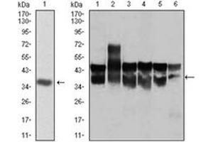 Western Blotting (WB) image for anti-Cyclin-Dependent Kinase 2 (CDK2) antibody (ABIN1106645) (CDK2 anticorps)
