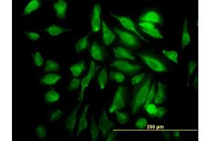 Immunofluorescence of monoclonal antibody to SH3D19 on HeLa cell.