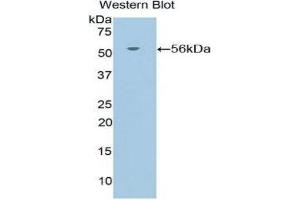 Western Blotting (WB) image for anti-Nuclear Receptor Subfamily 3, Group C, Member 1 (Glucocorticoid Receptor) (NR3C1) (AA 532-730) antibody (ABIN1860047)