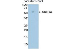 Western Blotting (WB) image for anti-Nuclear Receptor Subfamily 3, Group C, Member 1 (Glucocorticoid Receptor) (NR3C1) (AA 532-730) antibody (ABIN1860047) (Glucocorticoid Receptor anticorps  (AA 532-730))
