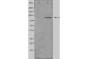Western blot analysis of extracts from K562 cells, using CDH3 antibody.