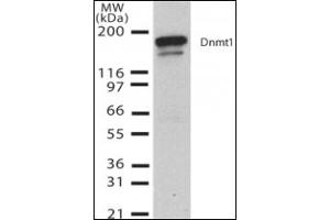 Western Blotting (WB) image for anti-DNA (Cytosine-5)-Methyltransferase 1 (DNMT1) (AA 637-650) antibody (ABIN492452) (DNMT1 anticorps  (AA 637-650))