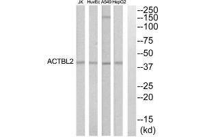 Western blot analysis of extracts from HepG2, HuvEc, Jurkat and A549 cells, using ACTBL2 antibody. (ACTBL2 anticorps  (Internal Region))