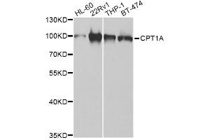 Western blot analysis of extracts of various cell lines, using CPT1A Antibody (ABIN5973053) at 1/1000 dilution. (CPT1A anticorps)