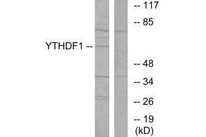 Western blot analysis of extracts from 293 cells, using YTHDF1 antibody. (YTHDF1 anticorps  (N-Term))