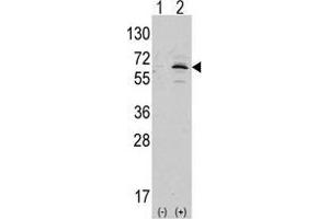 Western blot analysis of APPBP1 (arrow) using rabbit polyclonal APPBP1 Antibody (C-term) (AP13996PU-N ). (NAE1 anticorps  (C-Term))