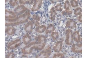 DAB staining on IHC-P; Samples: Mouse Kidney Tissue (CBY1/PGEA1 anticorps  (AA 7-127))