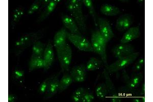 Immunofluorescence of monoclonal antibody to S100B on HeLa cell . (S100B anticorps  (AA 1-92))