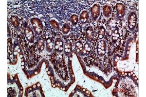 Immunohistochemical analysis of paraffin-embedded human-small-intestine, antibody was diluted at 1:200