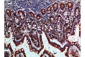 Immunohistochemical analysis of paraffin-embedded human-small-intestine, antibody was diluted at 1:200 (BTLA anticorps  (AA 101-150))