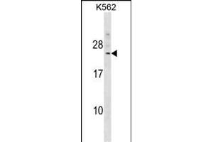 DCAKD Antibody (N-term) (ABIN1539435 and ABIN2849301) western blot analysis in K562 cell line lysates (35 μg/lane). (DCAKD anticorps  (N-Term))