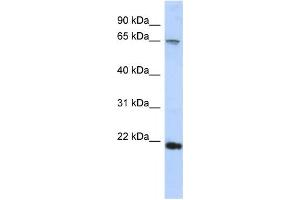 Western Blotting (WB) image for anti-Fibrinogen Silencer Binding Protein (FSBP) antibody (ABIN2457977)