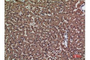 Immunohistochemistry (IHC) analysis of paraffin-embedded Human Liver, antibody was diluted at 1:100.