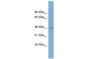WB Suggested Anti-A4GALT Antibody Titration:  0. (A4GALT anticorps  (Middle Region))