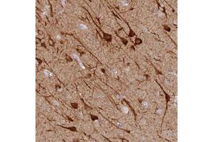 Immunohistochemical staining of human cerebral cortex with MCCD1 polyclonal antibody  shows strong cytoplasmic positivity in neuronal cells at 1:20-1:50 dilution. (MCCD1 anticorps)