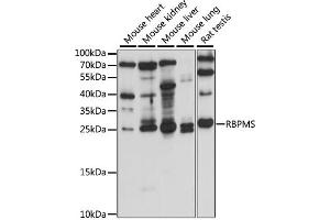 Western blot analysis of extracts of various cell lines, using RBPMS antibody (ABIN7270097) at 1:1000 dilution.