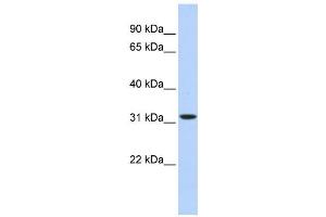 Western Blotting (WB) image for anti-3-hydroxyisobutyrate Dehydrogenase (HIBADH) antibody (ABIN2459627) (HIBADH anticorps)