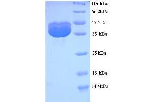 VP2 (AA 2-344) protein (His tag)