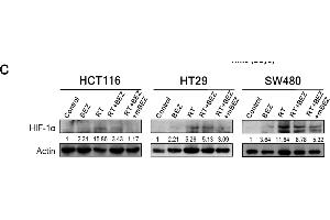 BEZ235 maintenance treatment following RT + BEZ235 treatment sensitized CRC cells to radiation by attenuating mTOR signaling- and angiogenesis-associated molecules.