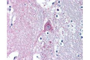 Immunohistochemical (Formalin/PFA-fixed paraffin-embedded sections) staining in human brain (caduate) with MARK1 polyclonal antibody . (MARK1 anticorps)
