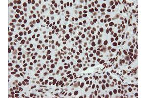 Image no. 4 for anti-Non-POU Domain Containing, Octamer-Binding (NONO) (AA 184-385) antibody (ABIN1491072) (NONO anticorps  (AA 184-385))