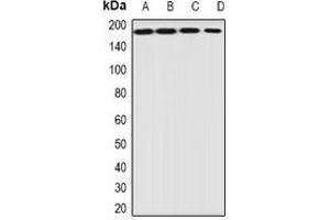 Western blot analysis of EIF3A expression in HepG2 (A), Jurkat (B), mouse heart (C), mouse ovary (D) whole cell lysates. (EIF3A anticorps)