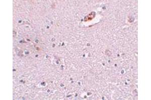 Immunohistochemical staining of human brain tissue with 5 ug/mL ZNF536 polyclonal antibody . (ZNF536 anticorps  (N-Term))