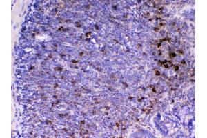 IHC analysis of CD14 using anti-CD14 antibody .