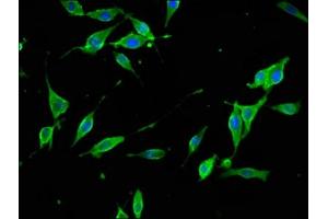 Immunofluorescence staining of NIH/3T3 cells with ABIN7171124 at 1:133, counter-stained with DAPI.