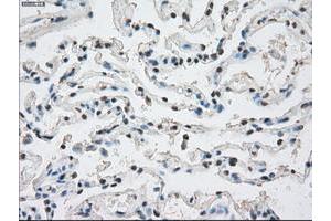 Image no. 8 for anti-Protein Phosphatase 5, Catalytic Subunit (PPP5C) antibody (ABIN1500389)