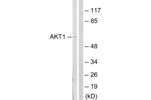 Western blot analysis of extracts from NIH/3T3cells, treated with PDGF (50mg /ml, 20mins), using Akt (epitope around residue 124) Antibody. (AKT1 anticorps  (Ser124))