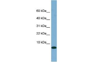 WB Suggested Anti-FABP1 Antibody Titration:  0. (FABP1 anticorps  (N-Term))
