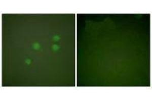 Immunofluorescence analysis of A549 cells, using Cyclin E1 antibody. (Cyclin E1 anticorps)