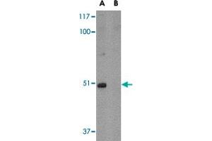 Western blot analysis of FNBP1L in mouse brain tissue lysate with in (A) the absence and (B) the presence of blocking peptide with FNBP1L polyclonal antibody  at 1 ug/mL . (FNBP1L anticorps  (C-Term))