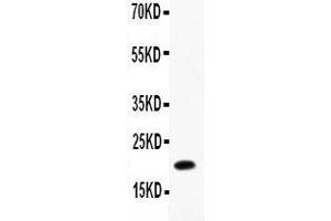 Anti-IL12 p40 Picoband antibody,  All lanes: Anti-IL12 P40 at 0. (IL12B anticorps  (AA 23-321))