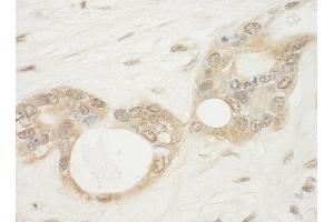 Immunohistochemistry (IHC) image for anti-WD Repeat Domain 5 (WDR5) (AA 50-100) antibody (ABIN7448863)