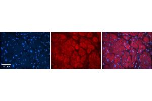 Rabbit Anti-Tmed1 Antibody    Formalin Fixed Paraffin Embedded Tissue: Human Adult heart  Observed Staining: Cytoplasmic (resembles Golgi) Primary Antibody Concentration: 1:600 Secondary Antibody: Donkey anti-Rabbit-Cy2/3 Secondary Antibody Concentration: 1:200 Magnification: 20X Exposure Time: 0. (TMED1 anticorps  (N-Term))