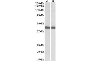 AP22441PU-N IDH1 antibody staining of Mouse (A) and Rat (B) Liver lysates at 0. (Isocitrate Dehydrogenase anticorps  (Internal Region))